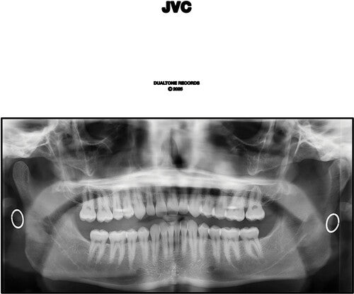 Jvc [2LP]