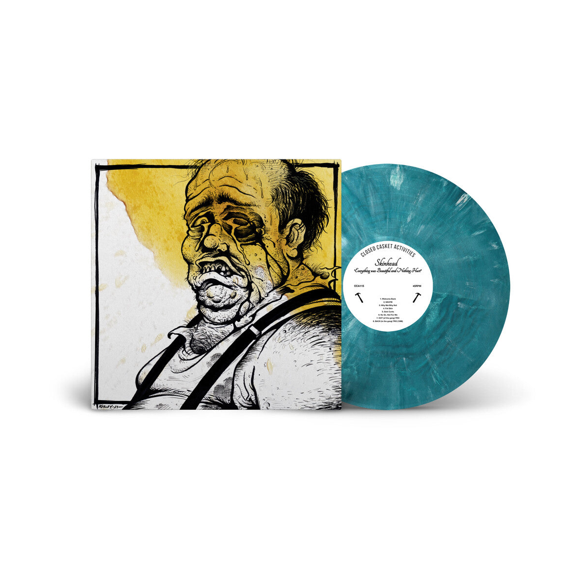 Skinhead - Everything Was Beautiful, And Nothing Hurt [Teal & White Marble LP] cover artwork